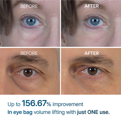 Crema para ojos Eloria Eyephalt