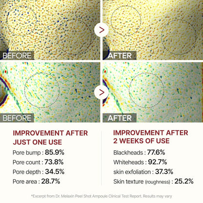 Eloria Rice Peel Serum Ampoule™