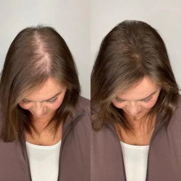 Champú orgánico de romero para el crecimiento del cabello